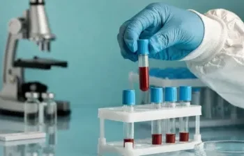 पश्चिम बंगाल में निपाह वायरस के दो केस सामने आए, केंद्र ने जारी किया हेल्पलाइन नंबर