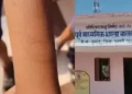 छत्तीसगढ़ के इस जिले में 35 बच्चों ने काटी कलाई, स्कूल से इलाके तक हड़कंप