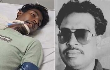 तरबूज फिर बना जानलेवा… पिता की मौत, बेटा वेंटिलेटर पर लड़ रहा जिंदगी की जंग