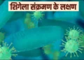 इस राज्य में फेल रहा है शिगेला संक्रमण का प्रकोप: बच्चों में बढ़ते मामले, अब तक इतने की मौत की पुष्टि