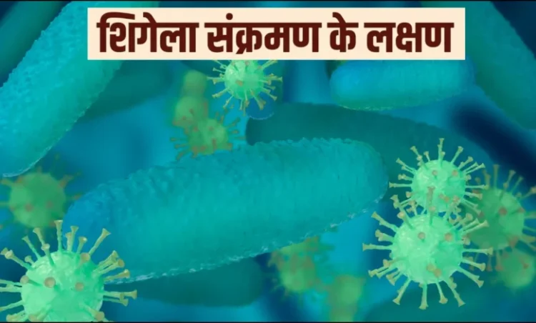 इस राज्य में फेल रहा है शिगेला संक्रमण का प्रकोप: बच्चों में बढ़ते मामले, अब तक इतने की मौत की पुष्टि