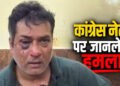 छत्तीसगढ़ में कांग्रेस नेता के घर घुसकर मारपीट, 15-20 बदमाशों ने किया हमला, भाजपा नेता पर लगा आरोप