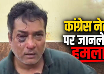 छत्तीसगढ़ में कांग्रेस नेता के घर घुसकर मारपीट, 15-20 बदमाशों ने किया हमला, भाजपा नेता पर लगा आरोप