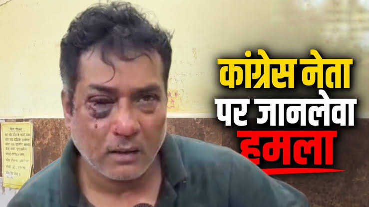 छत्तीसगढ़ में कांग्रेस नेता के घर घुसकर मारपीट, 15-20 बदमाशों ने किया हमला, भाजपा नेता पर लगा आरोप
